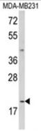 Interleukin-12 subunit alpha antibody, AP18069PU-N, Origene, Western Blot image 