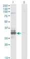 Tissue Factor Pathway Inhibitor 2 antibody, H00007980-M01, Novus Biologicals, Western Blot image 