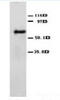 Angiopoietin 2 antibody, AP23297PU-N, Origene, Western Blot image 