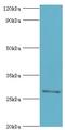 AlkB Homolog 2, Alpha-Ketoglutarate Dependent Dioxygenase antibody, LS-C377913, Lifespan Biosciences, Western Blot image 