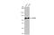 SATB Homeobox 1 antibody, GTX114738, GeneTex, Western Blot image 