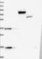 ACK1 antibody, NBP1-90822, Novus Biologicals, Western Blot image 