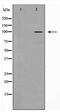 Catenin Alpha 1 antibody, TA347980, Origene, Western Blot image 