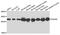 Phosphoglycerate Mutase 2 antibody, STJ110226, St John