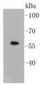 SMAD Family Member 3 antibody, NBP2-67434, Novus Biologicals, Western Blot image 