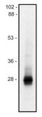 Lck Interacting Transmembrane Adaptor 1 antibody, AM12130PU-N, Origene, Western Blot image 