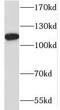 Variable charge Y chromosome 2-interacting protein 1 antibody, FNab04975, FineTest, Western Blot image 
