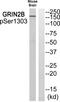 Glutamate receptor ionotropic, NMDA 2B antibody, PA5-37590, Invitrogen Antibodies, Western Blot image 