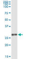 Vascular Endothelial Growth Factor B antibody, LS-C198427, Lifespan Biosciences, Immunoprecipitation image 