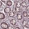 Zinc Finger Protein 555 antibody, HPA055430, Atlas Antibodies, Immunohistochemistry paraffin image 