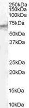 Signal Transducing Adaptor Molecule 2 antibody, GTX89357, GeneTex, Western Blot image 