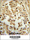 Eukaryotic Translation Initiation Factor 4E antibody, 60-601, ProSci, Immunohistochemistry paraffin image 