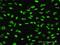 PLAG1 Zinc Finger antibody, H00005324-M07, Novus Biologicals, Immunocytochemistry image 