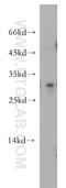 Interleukin 24 antibody, 12064-1-AP, Proteintech Group, Western Blot image 