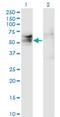 TSPY Like 1 antibody, H00007259-M01, Novus Biologicals, Western Blot image 