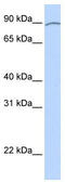 Apoptosis Resistant E3 Ubiquitin Protein Ligase 1 antibody, TA335995, Origene, Western Blot image 