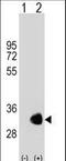 Glycine N-Methyltransferase antibody, LS-C159749, Lifespan Biosciences, Western Blot image 