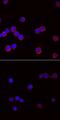 Lymphocyte Cytosolic Protein 2 antibody, MAB7474, R&D Systems, Immunofluorescence image 