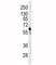 6-Phosphofructo-2-Kinase/Fructose-2,6-Biphosphatase 3 antibody, F51072-0.4ML, NSJ Bioreagents, Western Blot image 
