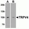 Transient Receptor Potential Cation Channel Subfamily V Member 4 antibody, TA326707, Origene, Western Blot image 