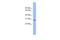 Enolase-Phosphatase 1 antibody, A11419, Boster Biological Technology, Western Blot image 