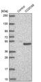 Coiled-Coil Domain Containing 68 antibody, PA5-61687, Invitrogen Antibodies, Western Blot image 
