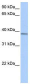 Acyl-CoA Dehydrogenase Short/Branched Chain antibody, TA335016, Origene, Western Blot image 