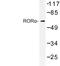 RAR Related Orphan Receptor A antibody, LS-C176905, Lifespan Biosciences, Western Blot image 