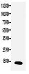 Trefoil Factor 1 antibody, PA5-80109, Invitrogen Antibodies, Western Blot image 