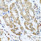 Anthrax toxin receptor 2 antibody, LS-C408979, Lifespan Biosciences, Immunohistochemistry frozen image 