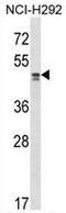 Transcriptional Adaptor 2A antibody, AP54139PU-N, Origene, Western Blot image 