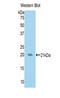 Activin A Receptor Type 2A antibody, LS-C300093, Lifespan Biosciences, Western Blot image 