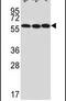 U3 small nucleolar RNA-associated protein 6 homolog antibody, PA5-25220, Invitrogen Antibodies, Western Blot image 