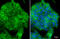 Cadherin 1 antibody, GTX100443, GeneTex, Immunocytochemistry image 