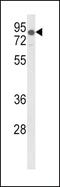 Low Density Lipoprotein Receptor antibody, MBS9202946, MyBioSource, Western Blot image 