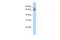 PHD Finger Protein 20 Like 1 antibody, PA5-43619, Invitrogen Antibodies, Western Blot image 