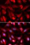 SMAD Family Member 4 antibody, LS-C334197, Lifespan Biosciences, Immunofluorescence image 