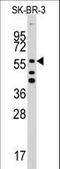 Aldehyde Dehydrogenase 5 Family Member A1 antibody, LS-B9003, Lifespan Biosciences, Western Blot image 