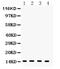 Fatty Acid Binding Protein 4 antibody, PA5-79231, Invitrogen Antibodies, Western Blot image 