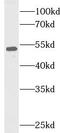 TNF Receptor Associated Factor 2 antibody, FNab10115, FineTest, Western Blot image 