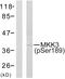 Mitogen-Activated Protein Kinase Kinase 3 antibody, LS-C199260, Lifespan Biosciences, Western Blot image 