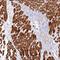 TNFAIP3 Interacting Protein 1 antibody, NBP1-89306, Novus Biologicals, Immunohistochemistry frozen image 