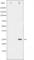 Troponin I3, Cardiac Type antibody, abx012283, Abbexa, Western Blot image 