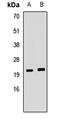 Potassium Voltage-Gated Channel Subfamily E Regulatory Subunit 2 antibody, LS-C668648, Lifespan Biosciences, Western Blot image 