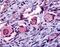 Nuclear Receptor Subfamily 4 Group A Member 1 antibody, MBS395911, MyBioSource, Immunohistochemistry paraffin image 