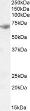 Tyrosine-protein kinase ITK/TSK antibody, LS-B5130, Lifespan Biosciences, Western Blot image 