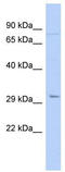 Paired Like Homeodomain 2 antibody, TA330536, Origene, Western Blot image 