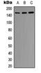 Insulin Receptor antibody, LS-C368392, Lifespan Biosciences, Western Blot image 