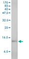 Serum amyloid A-1 protein antibody, LS-C105020, Lifespan Biosciences, Western Blot image 