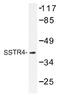 Somatostatin Receptor 4 antibody, AP01432PU-N, Origene, Western Blot image 